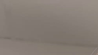 Teen with braces brushes teeth