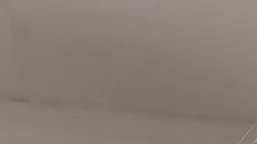 Teen with braces brushes teeth